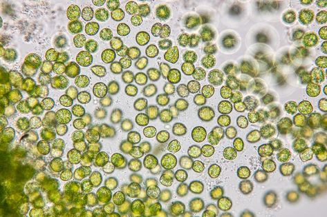 Chlorella under the microscope in Lab. Education of chlorella under the microsco , #Aff, #microscope, #Chlorella, #Lab, #chlorella, #Education #ad University Of Southampton, Under The Microscope, Human Genome, Green Algae, Mockups Design, Photosynthesis, Animals Of The World, How To Look Pretty, Face Mask