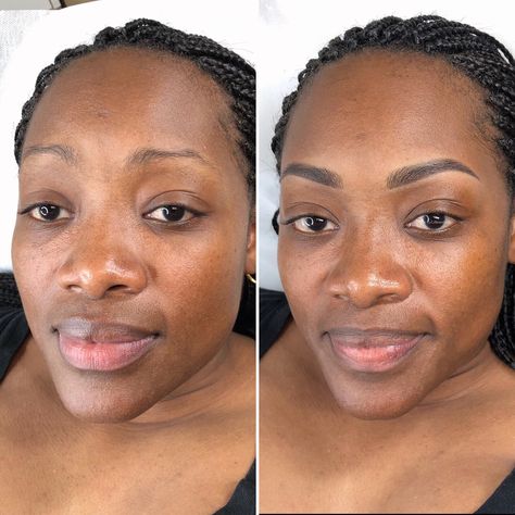 Microblading Combo Eyebrows, Microblading Eyebrows Black Women, Microbladed Eyebrows Black Women, Tattoo Eyebrows Before And After, Ombre Brows Black Women, Microblading On Black Women, Microblading Eyebrows Before And After, Brow Tattoo Permanent Makeup, Eyebrow Tattooing Permanent Makeup