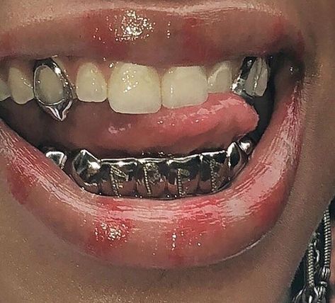 Braces, Piercings, Close Up