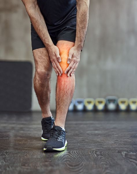 A Quick And Painless Introduction To Patellofemoral Pain Syndrome Patellofemoral Pain Syndrome, Sore Knees, Body Pain Relief, Knee Replacement Surgery, Knee Surgery, Knee Replacement, Joints Pain Relief, Body Pain, Muscle Pain