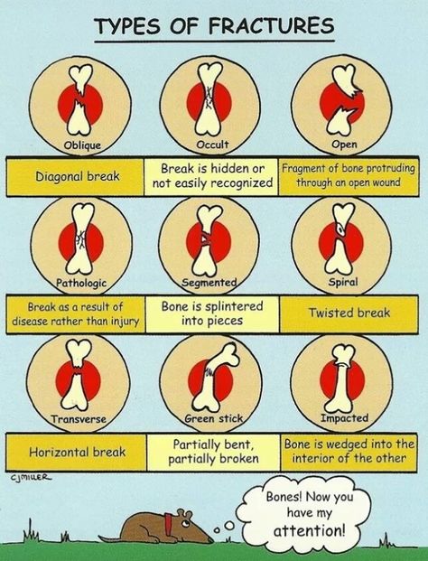 Types of fractures Medical Slp, Types Of Fractures, Orthopedic Nursing, Nursing Mnemonics, Nursing School Survival, Nursing School Studying, Nursing School Tips, Student Humor, Nursing School Notes