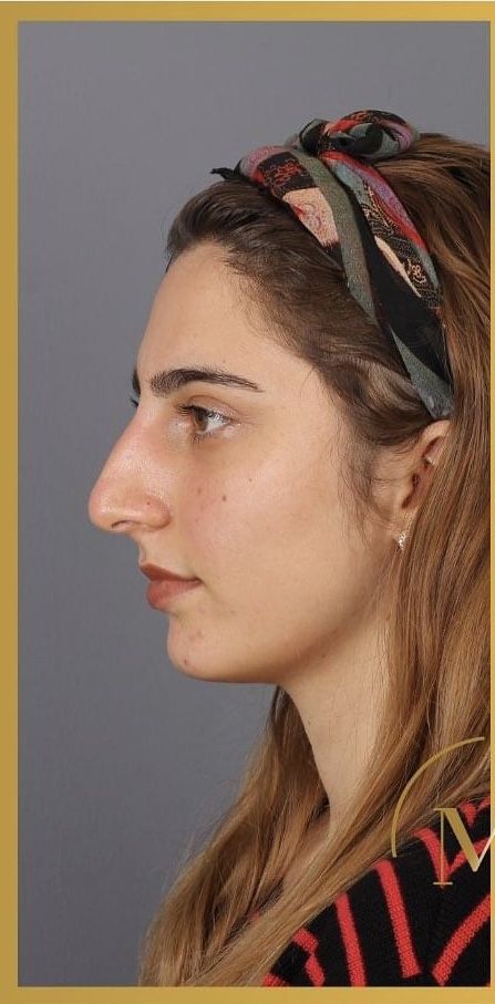 Side Profile Woman, Big Nose Beauty, Pretty Nose, Side Portrait, Face Profile, Nose Drawing, Clear Eyes, Female Profile, Big Nose