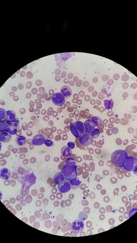 Hematology Aesthetic, Cells Aesthetic, Plant Cell Under Microscope, Skin Cells Microscope, Brain Cells Microscope, Cells Through Microscope, Microbiology Lab, Abnormal Cells, B Cell