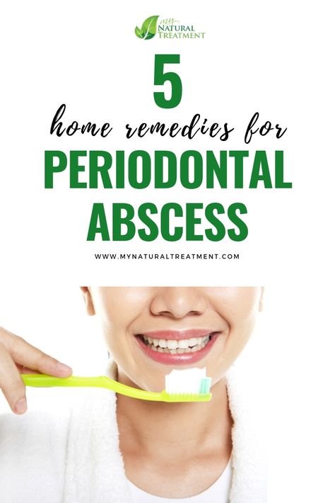 Here you have the most amazing home remedies for periodontal abscess using herbal teas and infusion and other simple home remedies. Dental Abscess, Abscess Tooth, Remedies For Dry Mouth, Home Remedies For Allergies, Teeth Remedies, Home Remedies For Warts, Warts Remedy, Remedies For Tooth Ache, Natural Remedies For Migraines