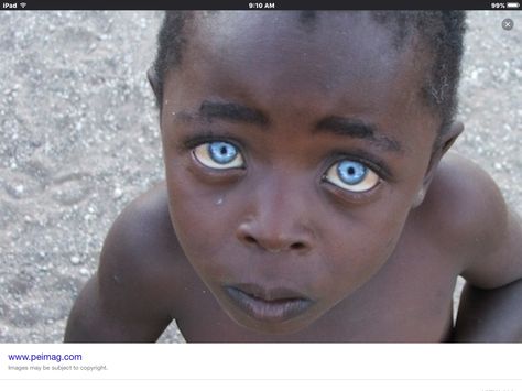 Light bright blue eyes Electric Blue Eyes, Genetic, Sapphire Eyes, English Girls, Bright Blue Eyes, Anthropology, Interesting History, People Of The World, Black People