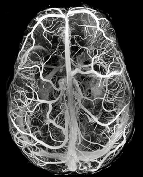 Neuroscience Art, Brain Art, How To Gain, Magnetic Resonance, Ap Art, Human Brain, Anatomy And Physiology, Neurology, Anatomy Art