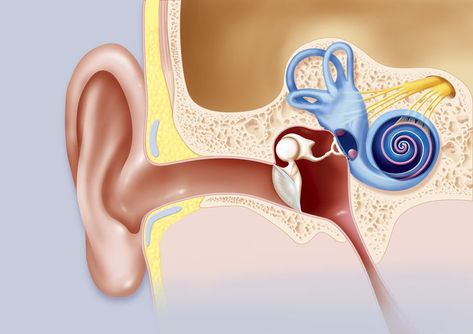 What's the Link Between Migraines and Ringing in Your Ears? Ms Flare Up Symptoms, Symptoms Of Ms Multiple Sclerosis, Symptoms Of Ms, Multiple Sclerosis Symptoms, Ms Symptoms, Migraine Attack, Cleaning Your Ears, Middle Ear, Ms Awareness