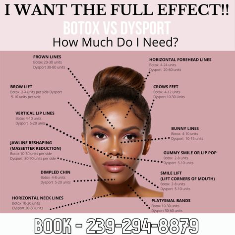 Botox Injection Sites Amounts, Botox Supplies, Dao Botox Injection Before And After, Botox Training For Nurses, How Many Units Of Botox Do I Need, Botox Face Mapping, Botox For Beginners, Dysport Injection Sites, Botox 11 Lines Before After