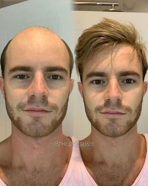 Male Wigs, Hair Pieces For Men, Hair Replacement For Men, Men Wigs, Hair Wigs For Men, Mens Toupee, Hair Replacement Systems, Dramatic Hair, Mens Wigs