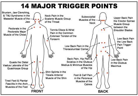 What is Trigger Point Therapy? Trigger Point Massage, Massage Therapy Techniques, Trigger Point Therapy, Ten Unit, Cupping Therapy, Trigger Point, Massage Benefits, Medical Anatomy, Acupressure Points