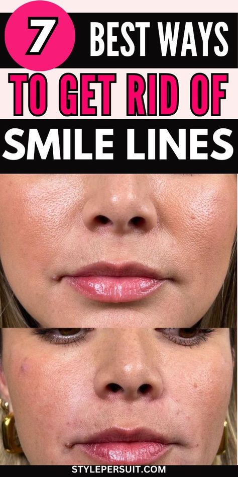 Smile lines, also known as laugh lines or nasolabial folds, are the creases that form around the mouth and nose as a natural part of aging. While they're a testament to a life filled with joy and laughter, some people may feel self-conscious about them and seek ways to minimize their appearance. While completely getting rid of smile lines may not be possible, there are several strategies to reduce their prominence and keep your skin looking youthful and vibrant. Lines Around Mouth, Wrinkles Under Eyes, Natural Wrinkle Remedies, Smile Wrinkles, At Home Skincare, Skin Home Remedies, Skin Care At Home, Skin Care Home Remedies, Wrinkle Remedies