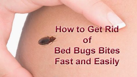 How to Get Rid of Bed Bugs Bites Fast and Easily | Arbkan Bed Bugs Bites, Bed Bug Bites Remedies, Bed Bug Bites Pictures, Essential Oils Bug Bites, Remedies For Bug Bites, Bed Bug Remedies, Mosquito Bite Itch, Remedies For Mosquito Bites, Bug Bites Remedies