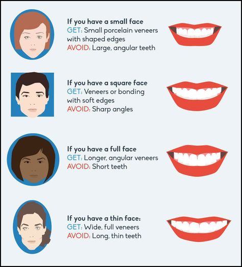 Suiting your face shape with tailored #teeth. Different Teeth Shapes, Beautiful Teeth Shape, Veneers Before And After Small Teeth, Teeth Shape Perfect, Teeth Shaping, Veneer Teeth, Dental Animation, Medical Items, Veneers Teeth