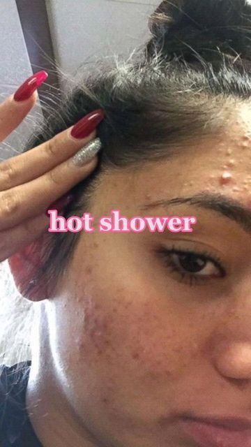 Asian Glow Up, Hot Shower Vs Cold, Cold Shower Benefits, Daily Routine Habits, Beginner Skin Care Routine, Acne Overnight, Vision Board Examples, Serious Skin Care, How To Get Rid Of Pimples