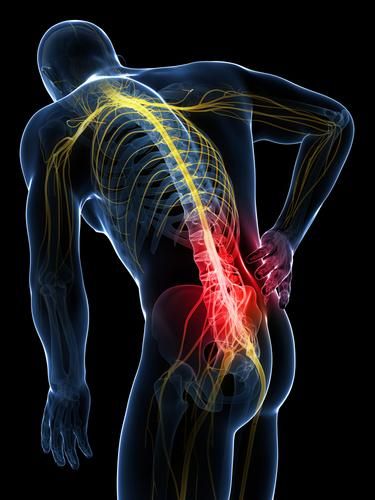 Rotator Cuff Injury, Disk Herniation, Sciatic Nerve Pain, Sciatica Pain, Rotator Cuff, Sciatic Nerve, Personal Injury Lawyer, Spinal Cord, Nerve Pain