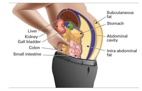 Kidney Detox, Body Flush, Office Exercise, Visceral Fat, Health Ideas, Body Organs, High Fat Diet, What Is The Difference Between, Insulin Resistance