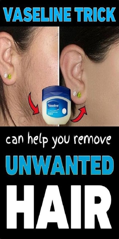 This Vaseline Trick Can Help You Remove Unwanted Hair Best Permanent Hair Removal, Brazilian Hair Removal, Permanent Hair Removal Cream, Permanent Facial Hair Removal, Back Hair Removal, Best Facial Hair Removal, Leg Hair Removal, Electrolysis Hair Removal, Lip Hair Removal