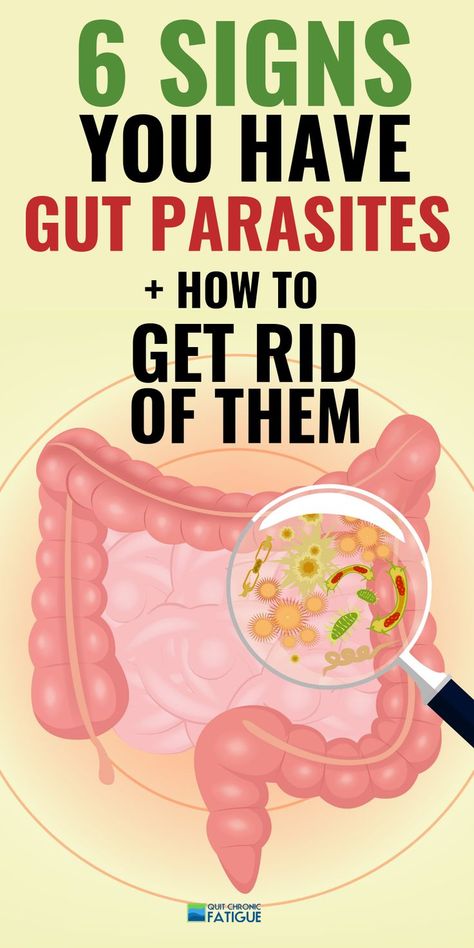 Stomach parasites symptoms - are they causing your fatigue or other health issues? #stoamchparasitessymptoms #stomachparasites #stomachparasitecleanse Parasites Symptoms, Home Remedies For Bronchitis, Cleaning Your Colon, Cough Remedies, Lose 40 Pounds, Good Health Tips, Chronic Fatigue, Health And Fitness Tips, Healthier You