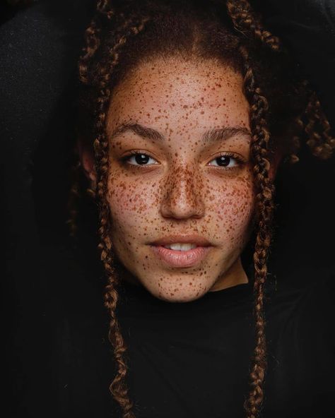 Poc Redhead, Black With Freckles, Female Redhead, Black Redhead, Black Girls With Freckles, Black Freckles, Girl With Freckles, Beautiful Black Queen, People With Freckles