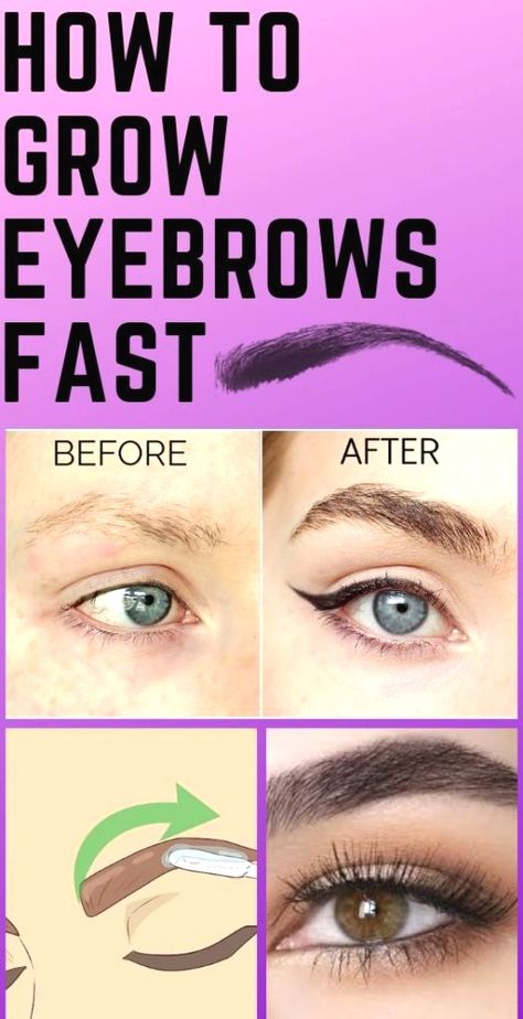 Grow Hair, Grow Eyebrows Faster, Grow Eyebrows Thicker, Beautiful Eyebrows, How To Grow Eyebrows, Thick Brows, Hair Growth Supplement, Thick Eyebrows, Hair Follicle