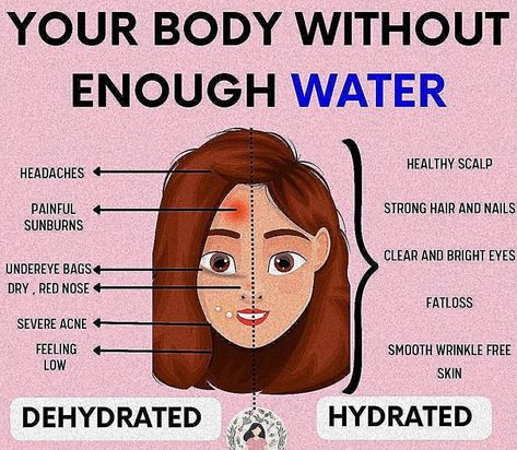 A tired and dehydrated person indicating the negative effects of not drinking enough water on the body. How To Get Rid Of Excess Body Water, How Much Water To Drink A Day For Clear Skin, Symptoms Of Dehydration, How To Remember To Drink Water, Fat Burning Machine, Heart Diet, When The Water Too Hot Meme, Severe Acne, Nerve Pain Relief