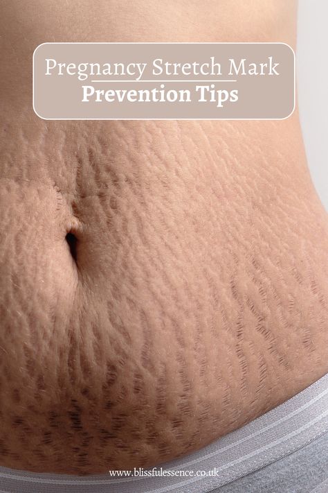 Discover expert tips to maintain flawless skin during pregnancy and prevent stretch marks. Embrace your beautiful changing body and enjoy a radiant pregnancy glow. #pregnancyjourney #pregnancytips #stretchmarkprevention #flawlessskin #skincareduringpregnancy #pregnancyskincare 📌 stretch mark prevention, how to get rid breakouts, it wrinkle cream 🎯 #dermatology #sulfatefree #puffiness Stretch Mark Prevention Pregnancy, Stretch Mark Prevention, Stretch Mark Removal Cream, Care During Pregnancy, Pregnancy Skincare, Stretch Mark Removal, Stretch Mark Cream, Stretch Mark, Pregnancy Journey