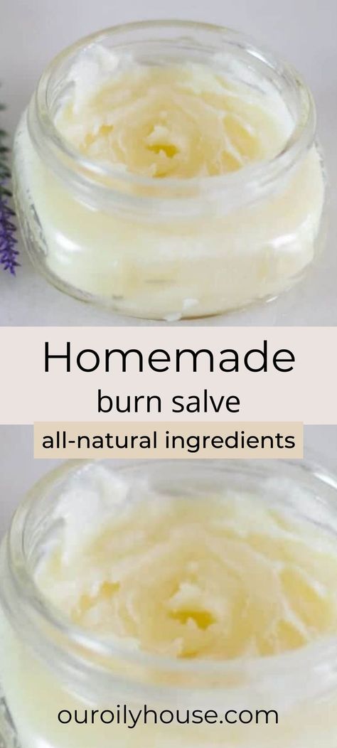 Burn Salve, Our Oily House, Burn Ointment, Burn Remedy, Salve Recipes, Healing Salves, Cold Sores Remedies, Cleaner Recipes, Natural Sleep Remedies