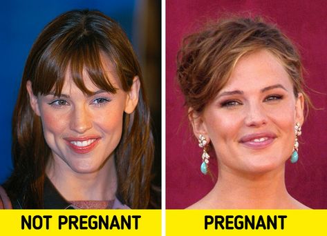 10 Celebrities Who Show How Women Change During Pregnancy Sarah Jessica Parker Pregnant, Celebrity Pregnancy Style, Celebrities Pregnant, Julie Edwards, Hiding Pregnancy, Women Smile, Susan Holmes, Celebrity Maternity Style, Celebrity Plastic Surgery