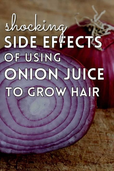 Hair Growth Onion Juice, Onion Remedy For Hair Growth, Onion Oil Benefits, Drinking Onion Water Benefits, Onion And Aloe Vera For Hair Growth, Onion Oil For Hair Growth Diy, Onion Shampoo For Hair Growth, How To Make Onion Water For Hair Growth, Rosemary Onion Hair