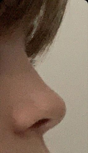 Nose Aesthetic, Upturned Nose, Haircut For Face Shape, Straight Nose, Pretty Nose, Perfect Nose, Small Nose, Button Nose, Nose Shapes