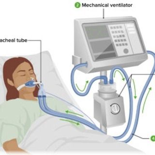 Mechanical ventilation is a critical component of modern healthcare, providing life-saving support to patients who cannot breathe adequately on their own. For nursing professionals, mastering the principles and practices of mechanical ventilation is essential, especially when preparing for the NCLEX exam. This guide will cover the fundamental aspects of mechanical ventilation, including basic principles, modes, settings, monitoring, complications, nursing considerations, and study resources. ... Health Care, Nclex, Nursing, Nclex Exam, Mechanical Ventilation, Professional Nurse, Study Resources, Saving Lives