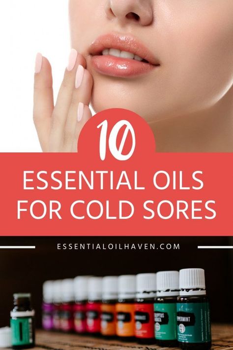 Essential oils are one of the most helpful remedies for cold sores. Find the top 10 oils here. Essential Oils For Cold Sores, Essential Oils For Fever, Cold Sore Essential Oil, Essential Oils For Cold, Fever Blister, Essential Oils For Colds, Essential Oils For Headaches, Cold Sores, Canker Sore