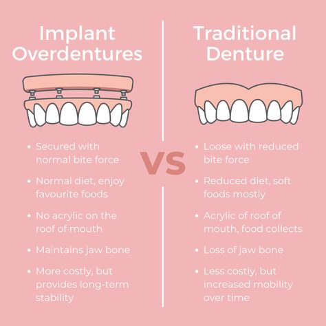 Dental Education For Patients, Dental Marketing Social Media, Dental Infographics, Dental Terminology, Dental Assistant School, Hygiene School, Dental Assistant Study, Dental Quotes, Dental Hygiene Student