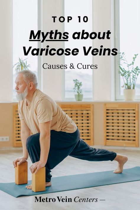 Varicose Vein Remedy Natural Treatments, Spider Vein Remedies, Vericous Veins, Varicose Veins Exercises, Varicose Veins Essential Oils, Varicose Vein Cream, Varicose Veins Causes, Vein Health, Varicose Vein Removal