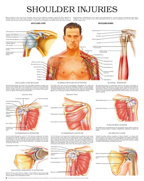 Shoulder injuries – Anejo Knee Fracture, Shoulder Rehab Exercises, Shoulder Anatomy, Rotator Cuff Exercises, Shoulder Pain Exercises, Vintage Nursing, Shoulder Rehab, Knee Ligaments, Shoulder Problem