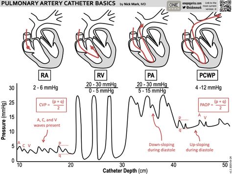 View in full resolution Cath Lab Nursing, Cath Lab Nurse, Arterial Line, Heart Pressure, Intracranial Pressure, Nurse Study Notes, One Pager, Cardiac Nursing, Critical Care Nursing