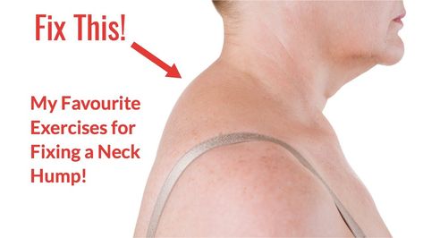 A Neck hump is also known as a Buffalo hump or a Dowager's hump. It is often due to a faulty posture and with the correct exercises, can be correcte... Bad Posture Exercises, Dowager's Hump, Být Fit, Better Posture Exercises, Posture Correction Exercises, Neck And Shoulder Exercises, Neck Hump, Tech Neck, Chiropractic Clinic