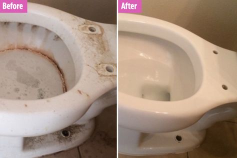 Professional cleaner reveals secret hack to remove tough toilet stains – and all you need is a pumice stone Toilet Stains Tough, Calcium Build Up Remover Toilet, Pumice Stone For Toilet, Toilet Bowl Ring Remover, Sun Mobile, Toilet Bowl Ring, Toilet Bowl Stains, Toilet Stains, Move Out Cleaning