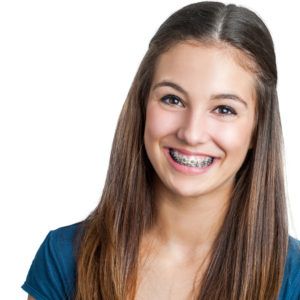 Diy Braces, Types Of Braces, Braces Girls, Dental Braces, Family Dental, Perfect Smile, Dental Practice, Girls Show, Photo Images