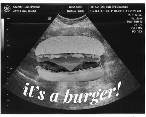 Creative Pregnancy Announcement Ideas 20 Weeks Pregnant Ultrasound, Sonogram Pictures, Creative Pregnancy Announcement, Menue Design, Food Photoshoot, Creative Advertising Design, Food Branding, Food Content, Food Advertising