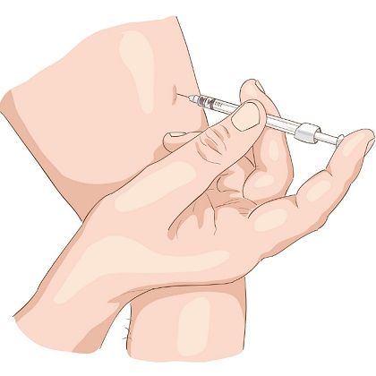 Injection Intramuscular Injection Sites, Injection Hand Pic, Insulin Injection, Injection Sites, Hand Pic, Vector Images Illustrations, Image Illustration, Vintage Art, Stock Vector