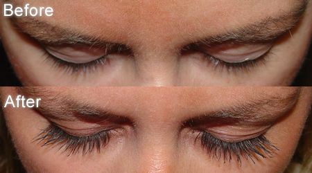 Latisse Before and after Lash Growing Serum, Grow Eyelashes Naturally, Grow Eyelashes, Best False Eyelashes, Thick Hair Remedies, Eyelash Brands, How To Grow Eyelashes, How To Grow Eyebrows, Beautiful Lashes