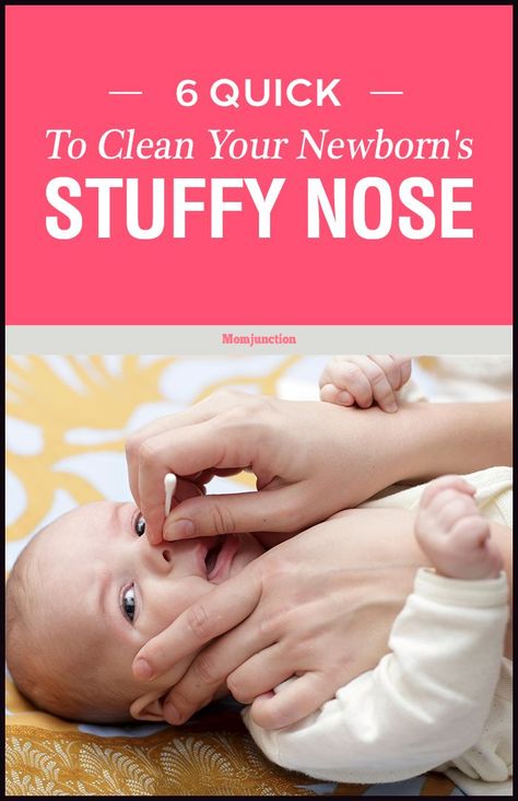 Newborn Congestion Relief, Newborn Stuffy Nose, Nasal Congestion Remedies, Baby Nasal Congestion, Baby Stuffy Nose, Safe Ideas, Nasal Congestion Relief, Congested Nose, Baby Remedies