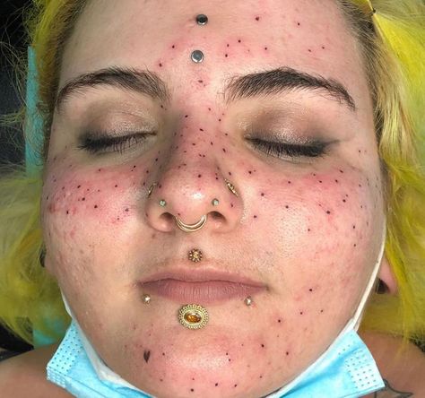 Not blackheads just tattooed "freckles" Hairstyles Back To School, Freckle Tattoo, Awful Tattoos, Tattooed Freckles, Situationship Quotes Feelings, Bendy Candles, Hair Fails, Scar Tattoo, Tattoo Fails