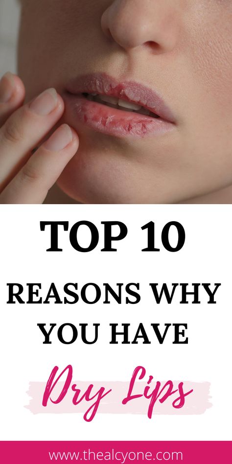 How To Have Healthy Lips, How To Take Care Of Your Lips, Peeling Lips Remedies, Natural Lip Moisturizer, What To Do For Dry Lips, How To Heal Cracked Lips, How To Treat Dry Lips, How To Not Have Dry Lips, Softer Lips Tips