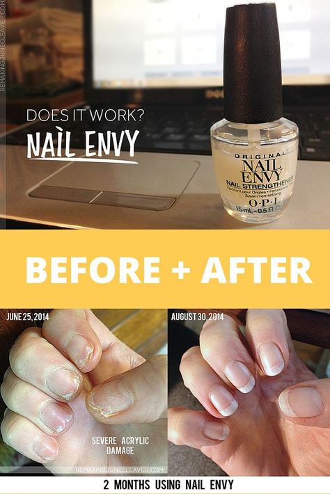 Nail Envy Opi, Nails After Acrylics, Nail Growth Tips, Opi Nail Envy, Natural Gel Nails, Natural Nail Care, Nails Care, Weak Nails, Broken Nails