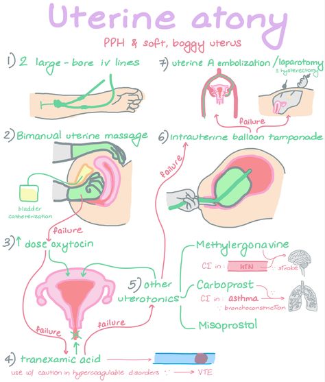 Fetal Monitoring Nursing, Nursing School Studying Cheat Sheets, Nursing School Inspiration, Midwifery Student, Student Midwife, Nursing School Essential, Nursing Study Guide, Medical School Life, Nurse Study Notes