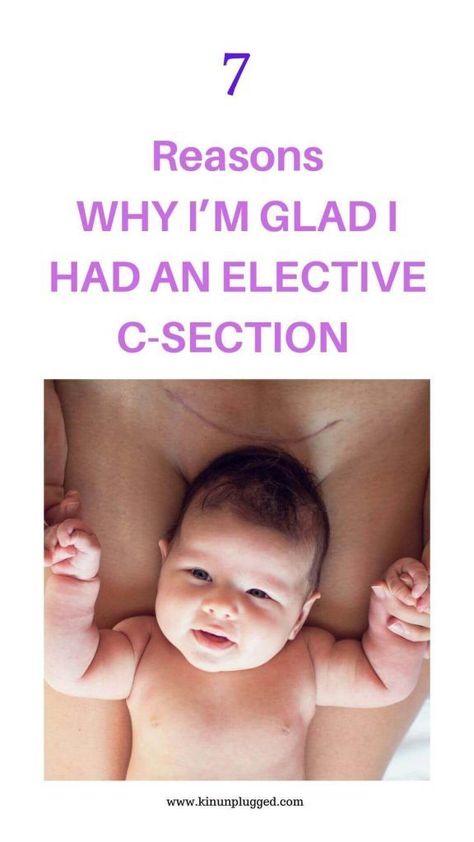 Emergency c-section vs. Planned Gentle C Section, Planned C Section, Elective C Section, Scheduled C Section, Taking Care Of Baby, Emergency C Section, C Section Recovery, Hospital Bag Checklist, High Iq