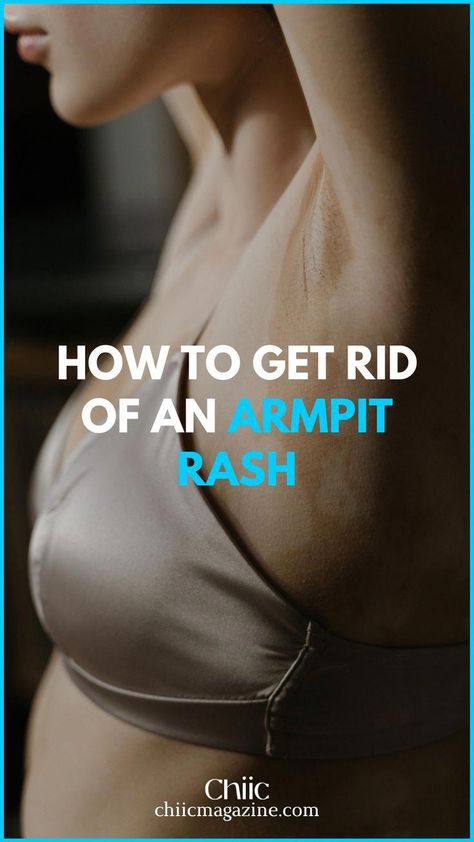 If you really want to remain the hot and beautiful chiic that you are, then you want to learn how to overcome a sweaty and dark armpit... Armpit Rash, Dark Armpits, Women Tips, Mexican Women, Women Magazines, Itchy Skin, Beauty Skincare, Health Advice, Natural Treatments