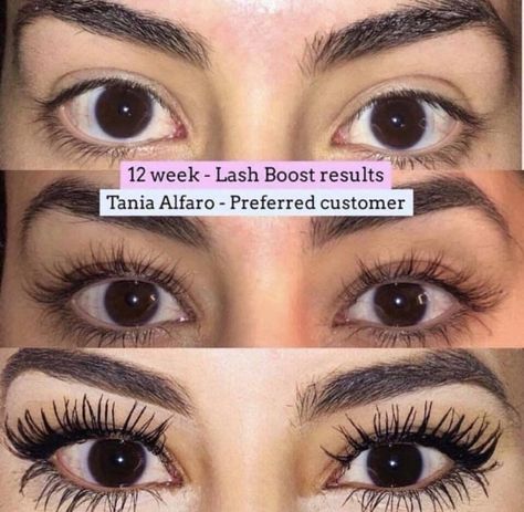 Dry Eyelids, Rodan Fields Lash Boost, Skincare Facts, Lash Princess, Rodan And Fields Consultant, Great Lash, Lash Boost, Life Changing Skincare, Alligator Skin